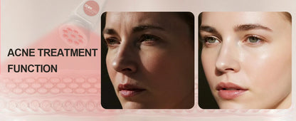 Kompakter, multifunktionaler Phototherapie-Detektor für Kosmetikprodukte der Unterhaltungselektronik, einschließlich Aknebehandlung und Hautaufhellung